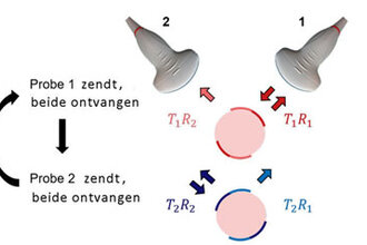 Echo, goedkoop en stralingsloos