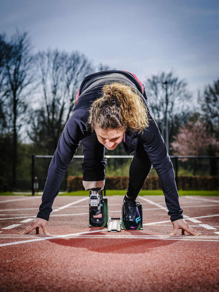 Annette Roozen met prothese