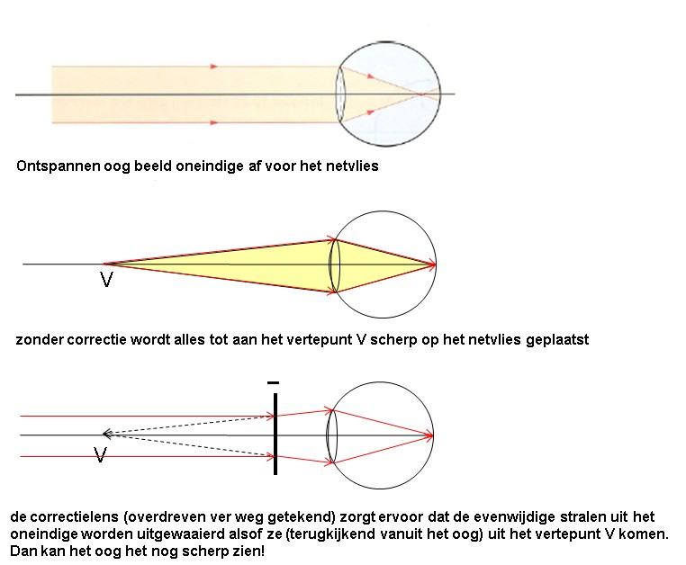 Natuurkunde.nl - Oogafwijking